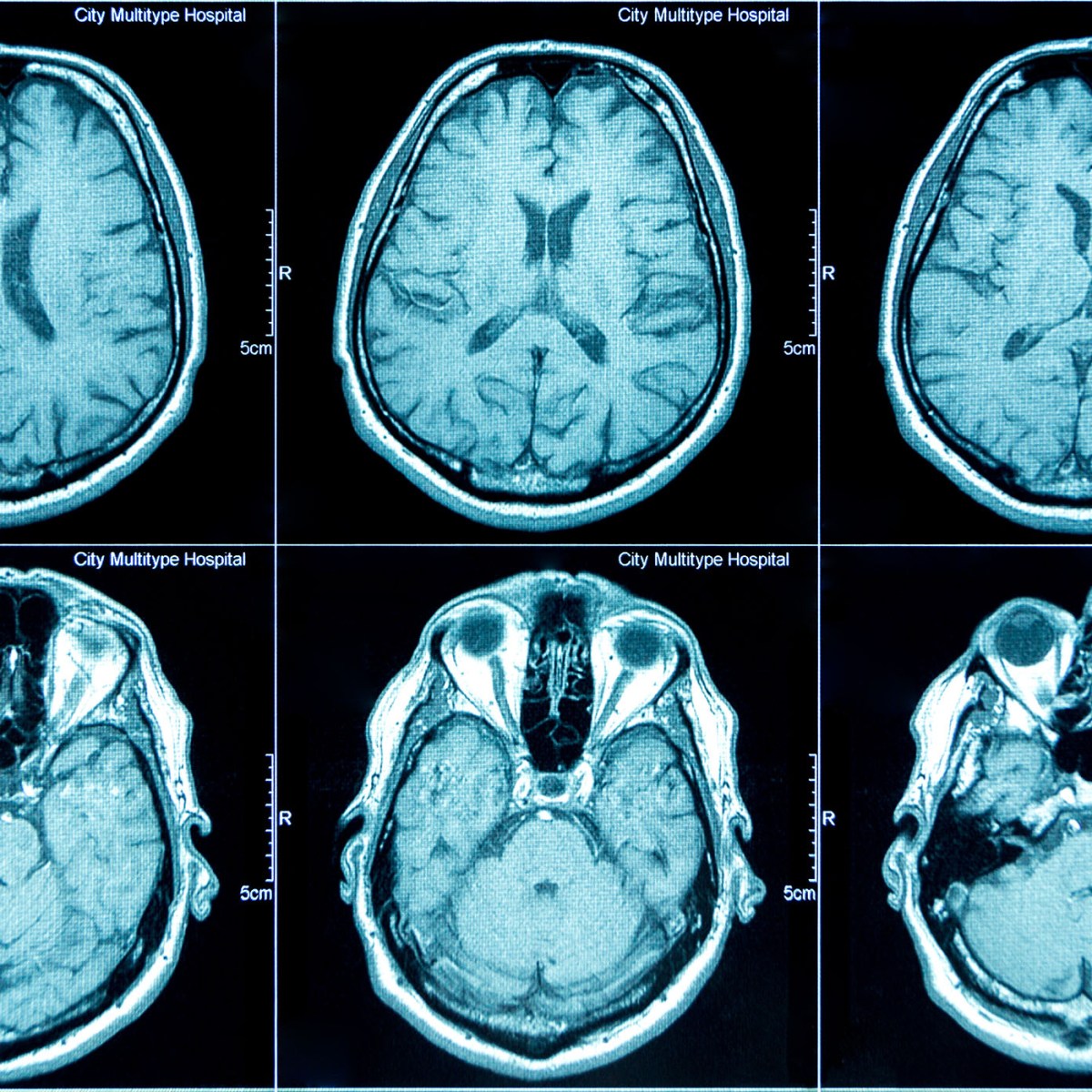 The Origin of a Broken&nbsp;Mind